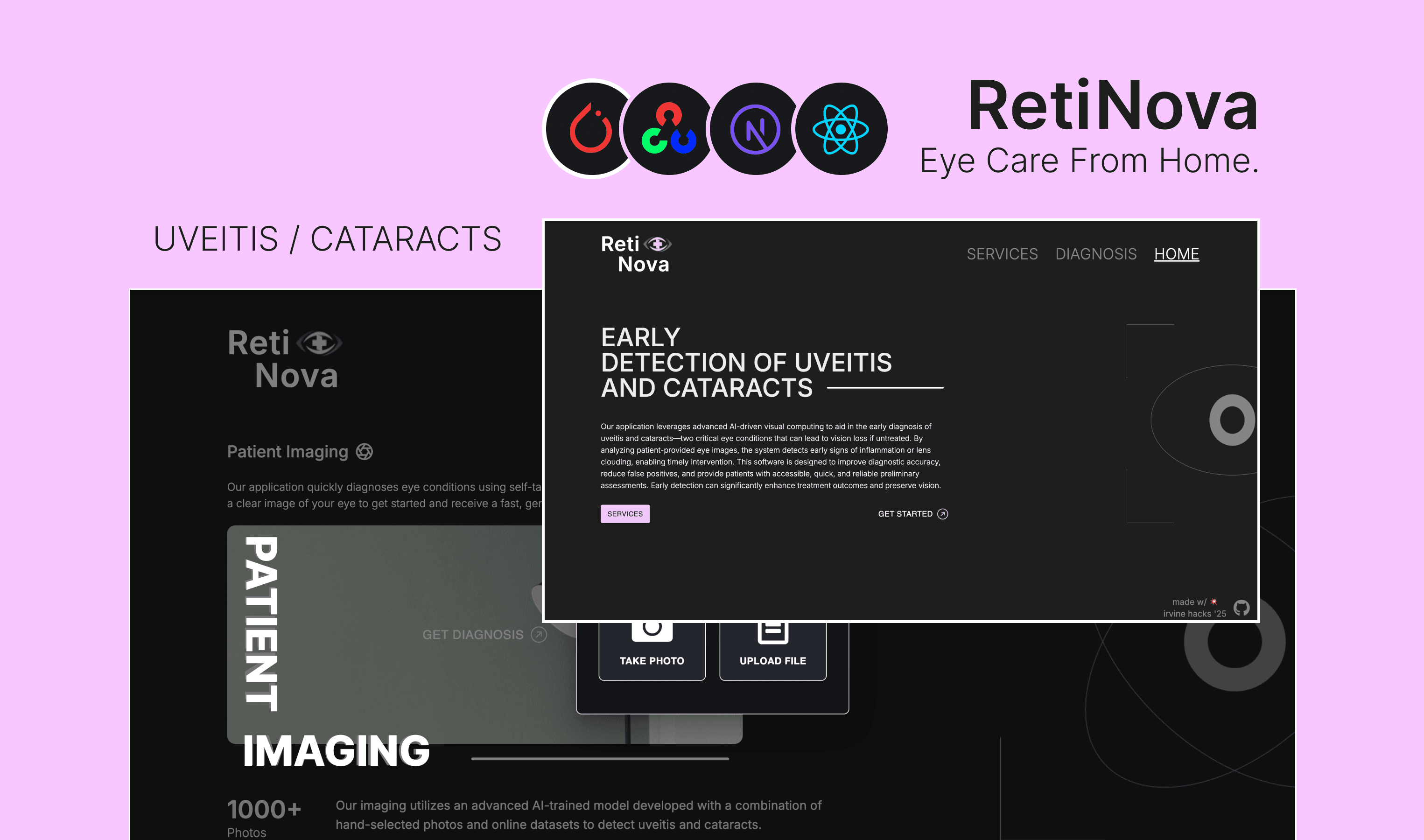 RetiNova 👁️
